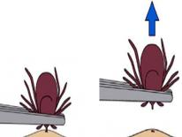 tick removal jpg 2