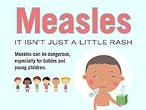 measles isn't just a little rash